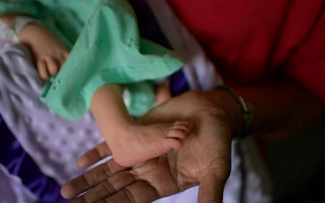 Al menos seis de cada 10 embarazadas en Venezuela presentan condiciones de riesgo